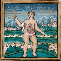 Dijete rođeno s izloženim crevima, poster Print od izvora nauke